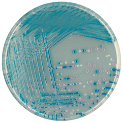Среда для выделения и дифференциации E.Coli O157 | CHROMagar™ O157  1000 мл CHROMagar